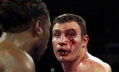 Broken nose in amateur boxing